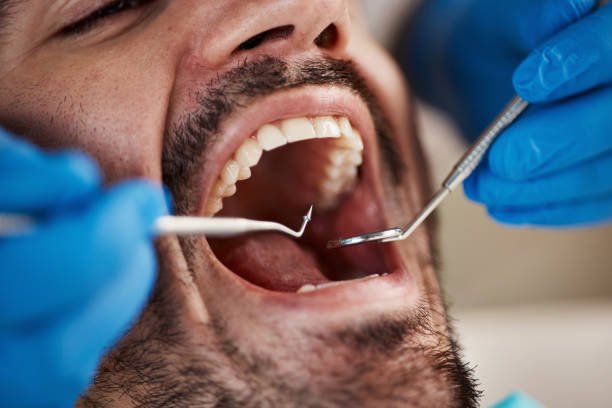 Best Emergency Cosmetic Dentistry (e.g., broken veneers) in Horn Lake, MS