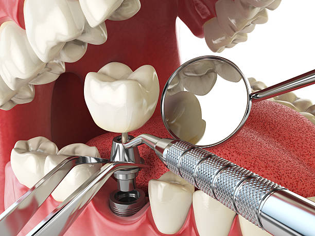 Professional Emergency Dental Service in MS